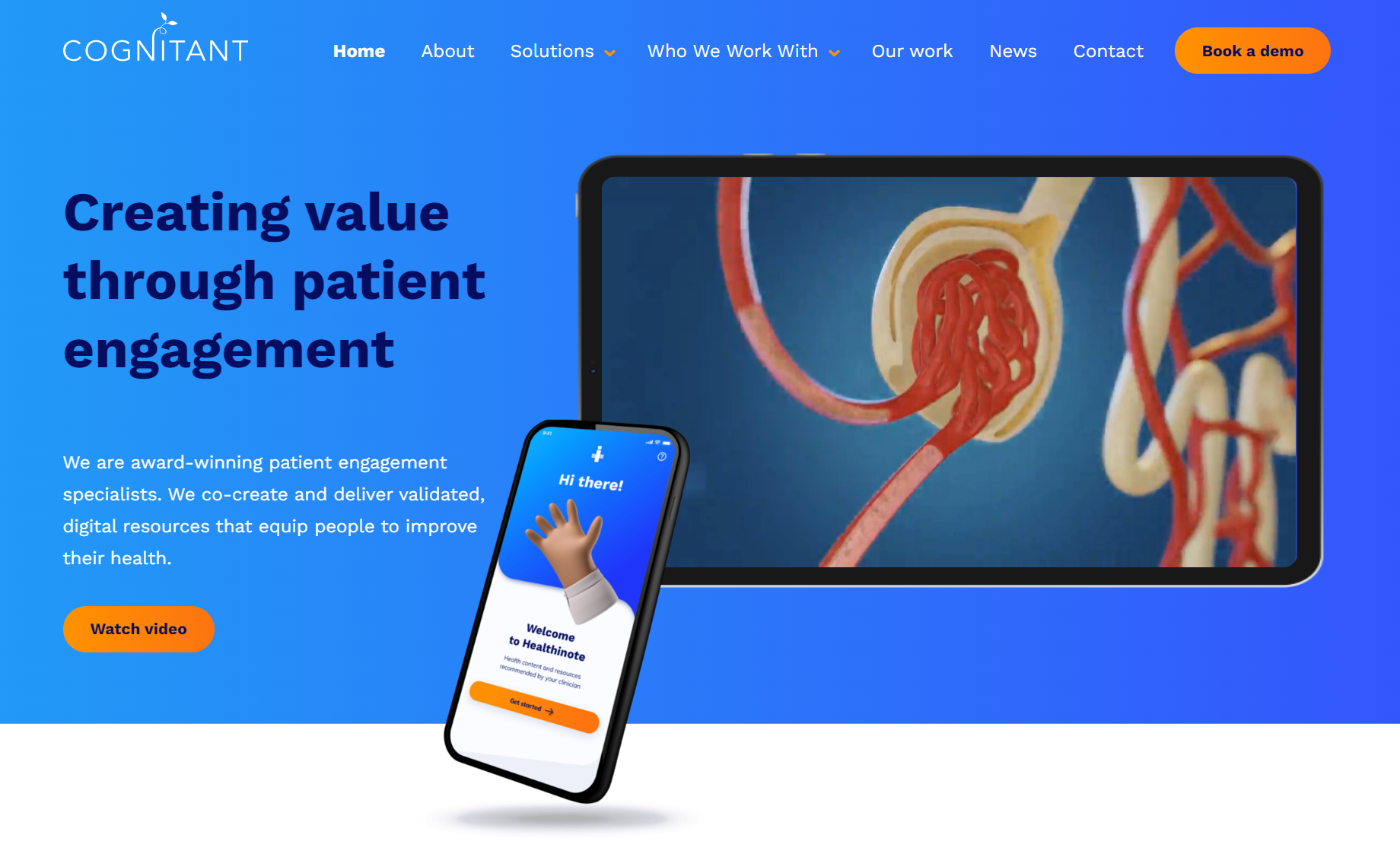 A Cognitant website screenshot showcases patient engagement, featuring a smartphone with a "Healthnote" app and a tablet with an anatomical rendering against a blue backdrop.